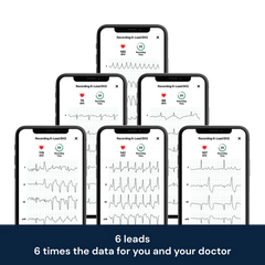 Alivecor KardiaMobile 6L 個人心電圖儀 – 六導聯心電監測