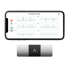 Alivecor KardiaMobile 6L 個人心電圖儀 – 六導聯心電監測